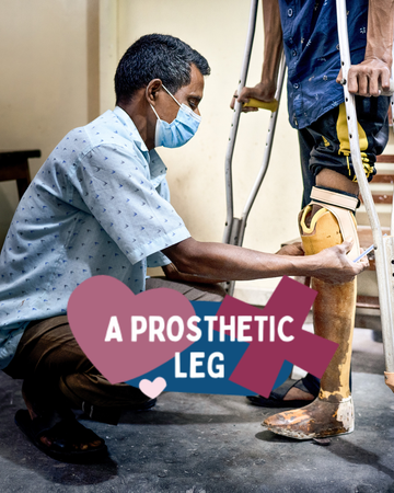 A Prosthetic Leg